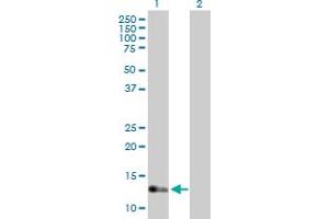 Western Blot analysis of IFT20 expression in transfected 293T cell line by IFT20 MaxPab polyclonal antibody. (IFT20 anticorps  (AA 1-148))