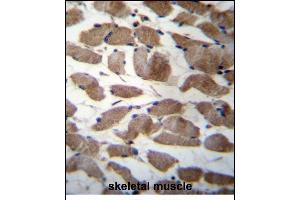 ACTN3 Antibody (Center) (ABIN656261 and ABIN2845575) immunohistochemistry analysis in formalin fixed and paraffin embedded human skeletal muscle followed by peroxidase conjugation of the secondary antibody and DAB staining. (ACTN3 anticorps  (AA 409-437))