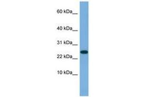 Image no. 1 for anti-Ankyrin Repeat Domain 39 (ANKRD39) (AA 35-84) antibody (ABIN6745692) (ANKRD39 anticorps  (AA 35-84))