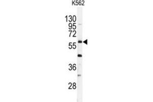 Western Blotting (WB) image for anti-Ubiquitin Specific Peptidase 2 (USP2) antibody (ABIN3001466) (USP2 anticorps)