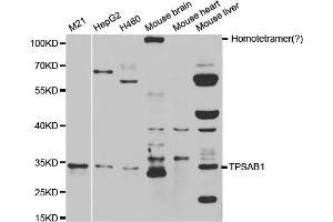 Western blot analysis of extracts of various cell lines, using TPSAB1 antibody. (TPSAB1 anticorps)
