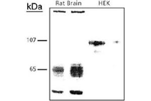 Western blot analysis of CADM1 in rat brain and HEK cell lysates in using CADM1 polyclonal antibody  . (CADM1 anticorps)