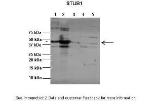 Lanes:   1:1ug insoluble STUB1 protein, 2:1ug soluble STUB1 protein, 3:1ug EPM2A protein, 4:1ug insoluble PPP1R3C protein, 5:1ug soluble PPP1R3C protein  Primary Antibody Dilution:   1:2500  Secondary Antibody:   Anti-rabbit-AP  Secondary Antibody Dilution:   1:20,000  Gene Name:   STUB1  Submitted by:   Pedro Castanheira, Biocant (STUB1 anticorps  (C-Term))