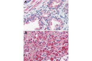 Immunohistochemical staining of formalin-fixed, paraffin-embedded human prostate (A) and human adrenal gland (B) tissue after heat-induced antigen retrieval. (CCKAR anticorps  (Internal Region))