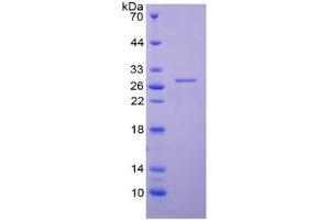 SDS-PAGE of Protein Standard from the Kit  (Highly purified E.