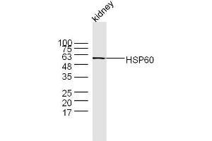 Mouse kidney lysates probed with Rabbit Anti-HSP60 Polyclonal Antibody  at 1:300 overnight at 4˚C. (HSPD1 anticorps  (AA 501-573))