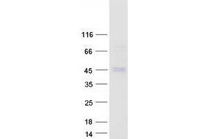 Validation with Western Blot