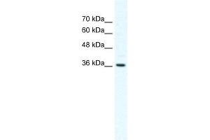 WB Suggested Anti-DVL1 Antibody Titration:  2. (DVL1 anticorps  (Middle Region))