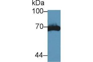 Western blot analysis of Mouse Kidney lysate, using Mouse tPA Antibody (5 µg/ml) and HRP-conjugated Goat Anti-Rabbit antibody ( (PLAT anticorps  (AA 359-532))