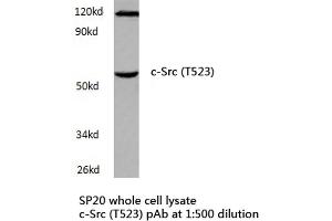 Western blot (WB) analyzes of c-Src antibody in extracts from SP20 cells. (NCOA1 anticorps)