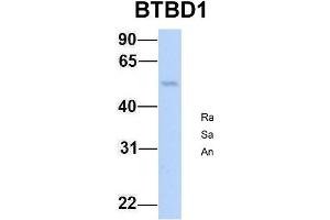 Host:  Rabbit  Target Name:  BTBD1  Sample Type:  Human Fetal Lung  Antibody Dilution:  1. (BTBD1 anticorps  (N-Term))