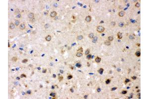 Anti- FE65 Picoband antibody, IHC(P) IHC(P): Mouse Brain Tissue