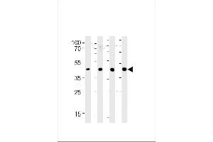 SRD5A3 Antibody (C-term) (ABIN651469 and ABIN2840258) western blot analysis in 293,LNCaP,PC-3,NCI- cell line lysates (35 μg/lane). (SRD5A3 anticorps  (C-Term))
