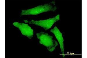 Immunofluorescence of monoclonal antibody to RBCK1 on HeLa cell.