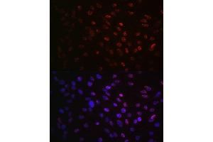 Immunofluorescence analysis of C6 cells using Phospho-p70 S6 Kinase 1-T421/S424 antibody (ABIN6135340, ABIN6136296, ABIN6136297 and ABIN7101878).