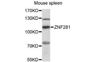 Western blot analysis of extracts of mouse spleen, using ZNF281 antibody (ABIN6291078) at 1:3000 dilution. (ZNF281 anticorps)