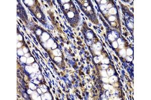 Immunohistochemistry of paraffin-embedded Rat ileum using ARID3A Polyclonal Antibody at dilution of 1:100 (40x lens).