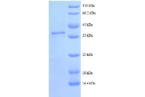 Secretory Leukocyte Peptidase Inhibitor (SLPI) (AA 26-132), (full length) protein (GST tag) (SLPI Protein (AA 26-132, full length) (GST tag))