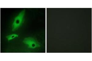 Immunofluorescence analysis of HeLa cells, using LTBR Antibody. (LTBR anticorps  (AA 11-60))