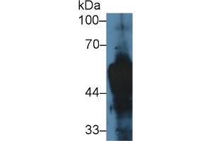 Western blot analysis of Rat Skin lysate, using Rat KRT14 Antibody (5 µg/ml) and HRP-conjugated Goat Anti-Rabbit antibody ( (KRT14 anticorps  (AA 122-429))