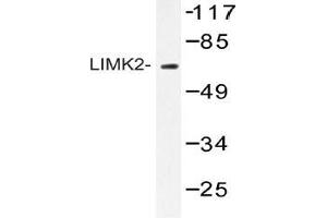 Western blot (WB) analysis of AP20423PU-N LIMK2 antibody in extracts from HepG2 cells. (LIMK2 anticorps)