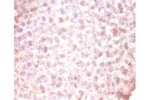 Immunohistochemistry of paraffin-embedded mouse liver tissue using ABIN7147238 at dilution of 1:100 (CDKN2AIPNL anticorps  (N-Term))