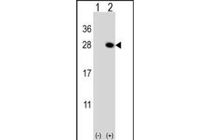 Western blot analysis of QDPR (arrow) using rabbit polyclonal QDPR Antibody (C-term) (ABIN652787 and ABIN2842516).