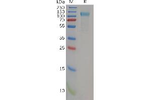 Human Protein, His Tag on SDS-PAGE under reducing condition.
