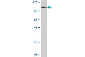 anti-Ribosomal Protein S6 Kinase, 90kDa, Polypeptide 1 (RPS6KA1) (AA 1-735) antibody