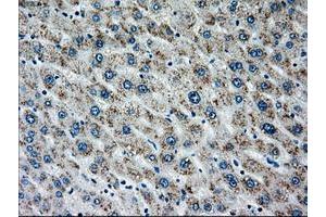 Image no. 7 for anti-Mitogen-Activated Protein Kinase Kinase 4 (MAP2K4) antibody (ABIN1499481)