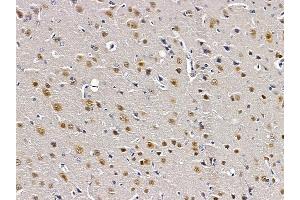 ABIN6261786 and ABIN6279146 at 1/100 staining rat brain tissue by IHC-P. (A2BP1 anticorps  (N-Term))