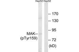 Western blot analysis of extracts from HepG2 cells treated with PMA 125ng/ml 30', using MAK (Phospho-Tyr159) Antibody. (MAK anticorps  (pTyr159))