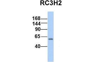Host:  Rabbit  Target Name:  RC3H2  Sample Type:  Human Fetal Lung  Antibody Dilution:  1. (RC3H2 anticorps  (Middle Region))
