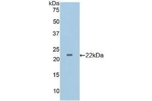 Detection of Recombinant GP4, Mouse using Polyclonal Antibody to Cluster Of Differentiation 36 (CD36) (CD36 anticorps  (AA 45-203))