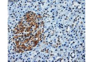 Immunohistochemical staining of paraffin-embedded liver tissue using anti-ATP5Bmouse monoclonal antibody. (ATP5B anticorps)