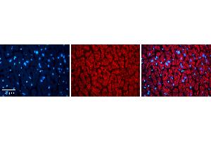 Rabbit Anti-TXN2 Antibody Catalog Number: ARP54910_P050 Formalin Fixed Paraffin Embedded Tissue: Human heart Tissue Observed Staining: Cytoplasmic Primary Antibody Concentration: N/A Other Working Concentrations: 1:600 Secondary Antibody: Donkey anti-Rabbit-Cy3 Secondary Antibody Concentration: 1:200 Magnification: 20X Exposure Time: 0.