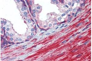 Prostate, Human: Formalin-Fixed, Paraffin-Embedded (FFPE)