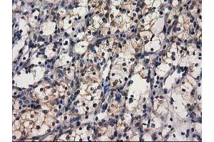 Image no. 9 for anti-Glucosidase, Beta, Acid 3 (Cytosolic) (GBA3) (AA 1-150), (AA 370-469) antibody (ABIN1490582)