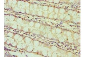 Immunohistochemistry of paraffin-embedded human colon tissue using ABIN7145641 at dilution of 1:100 (BAMBI anticorps  (AA 21-152))