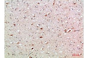 Immunohistochemical analysis of paraffin-embedded human-brain, antibody was diluted at 1:200