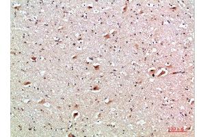 Immunohistochemical analysis of paraffin-embedded human-brain, antibody was diluted at 1:200 (CD137 anticorps  (AA 111-160))