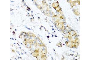 Immunohistochemistry of paraffin-embedded Human stomach using IFNL3 Polyclonal Antibody at dilution of 1:100 (40x lens). (IL28B anticorps)
