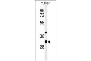 Western blot analysis of ECHDC1 Antibody in mouse liver tissue lysates (35ug/lane) (ECHDC1 anticorps  (C-Term))
