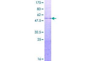 Image no. 1 for Deoxyuridine Triphosphatase (DUT) (AA 1-252) protein (GST tag) (ABIN1352150)