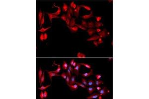 Immunofluorescence analysis of A-549 cells using GP9 Polyclonal Antibody (CD42a anticorps)