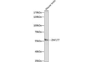 Western blot analysis of extracts of mouse testis, using ZNF177 antibody (ABIN7271461) at 1:1000 dilution. (ZNF177 anticorps  (AA 50-110))