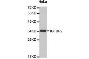 Western Blotting (WB) image for anti-Insulin-Like Growth Factor Binding Protein 2, 36kDa (IGFBP2) antibody (ABIN2650925) (IGFBP2 anticorps)