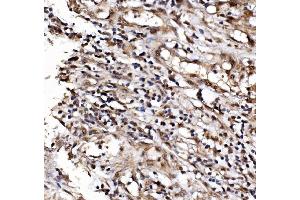 IHC analysis of IFI16 using anti-IFI16 antibody (ABIN7600374). (IFI16 anticorps  (AA 183-743))