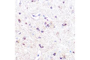 Immunohistochemistry of paraffin-embedded mouse spinal cord using IDO1 Rabbit mAb (ABIN7267863) at dilution of 1:100 (40x lens). (IDO1 anticorps)