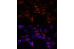 Immunofluorescence analysis of NIH/3T3 cells using STXBP1 antibody (ABIN6128255, ABIN6148673, ABIN6148674 and ABIN6221073) at dilution of 1:100 (40x lens).